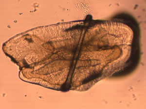 Researchers analyze fish otoliths using a laser to understand environmental changes related to the Kingston spill.