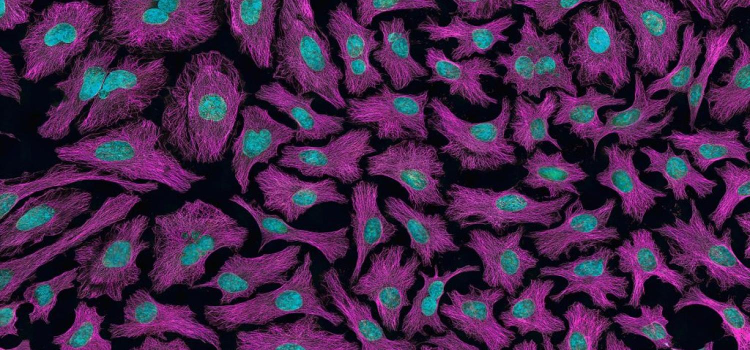 Image of blue and purple cells against black background.