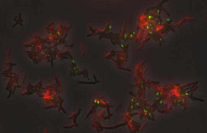 A co-culture of Actinobacteria-TM7, showing actinos in red and TM7 as the small green cells. Credit: Mircea Podar/Oak Ridge National Laboratory, U.S. Dept. of Energy.