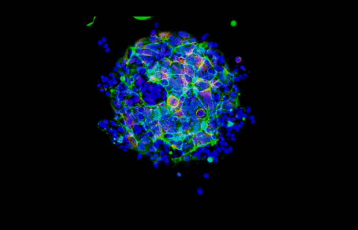 Debjani Pal’s photo “Three-Dimensional Breast Cancer Spheroids” won the Director’s Choice Award in Oak Ridge National Laboratory’s Art of Science photo competition. It will be displayed at the American Museum of Science and Energy in Oak Ridge, Tenn. Credit: Debjani Pal/ORNL, U.S. Dept. of Energy