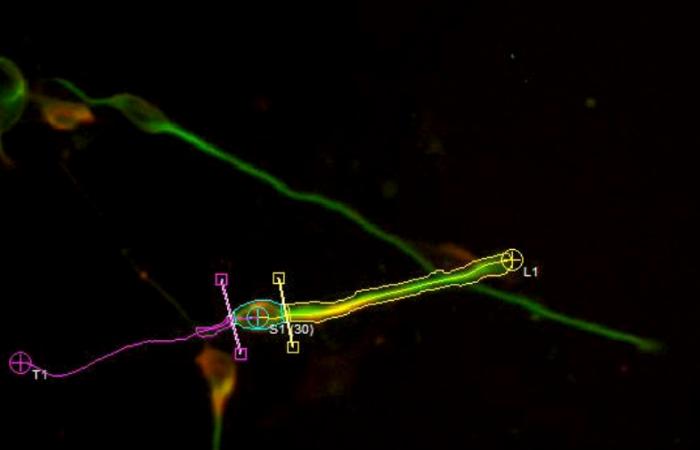 Measuring migrating neurons in a developing mouse brain