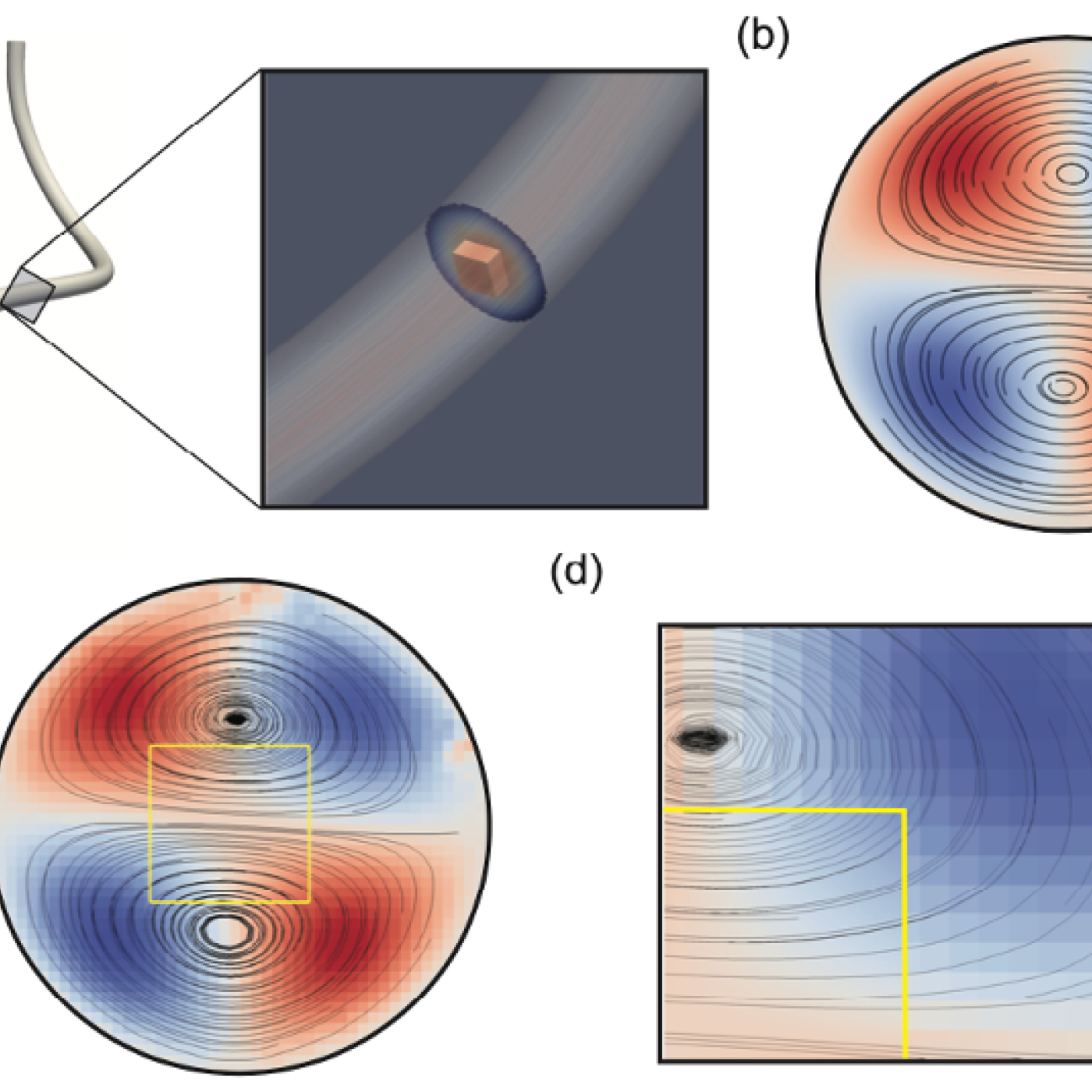 High Performance Adaptive Physics Refinement to Enable Large-Scale Tracking of Cancer Cell Trajectory