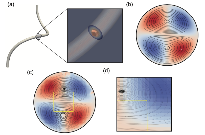 High Performance Adaptive Physics Refinement to Enable Large-Scale Tracking of Cancer Cell Trajectory