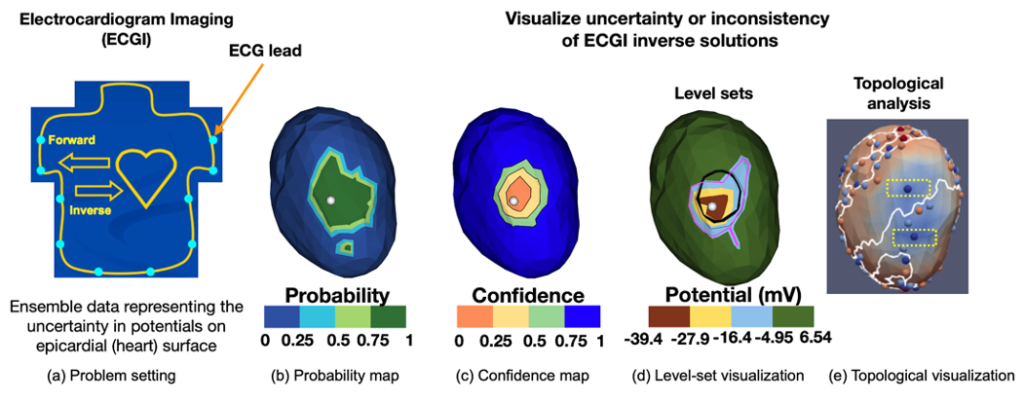 Quantifying and Visualizing Uncertainty for Source Localization in Electrocardiographic Imaging