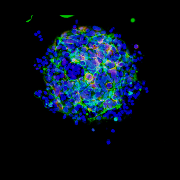 Debjani Pal’s photo “Three-Dimensional Breast Cancer Spheroids” won the Director’s Choice Award in Oak Ridge National Laboratory’s Art of Science photo competition. It will be displayed at the American Museum of Science and Energy in Oak Ridge, Tenn. Credit: Debjani Pal/ORNL, U.S. Dept. of Energy