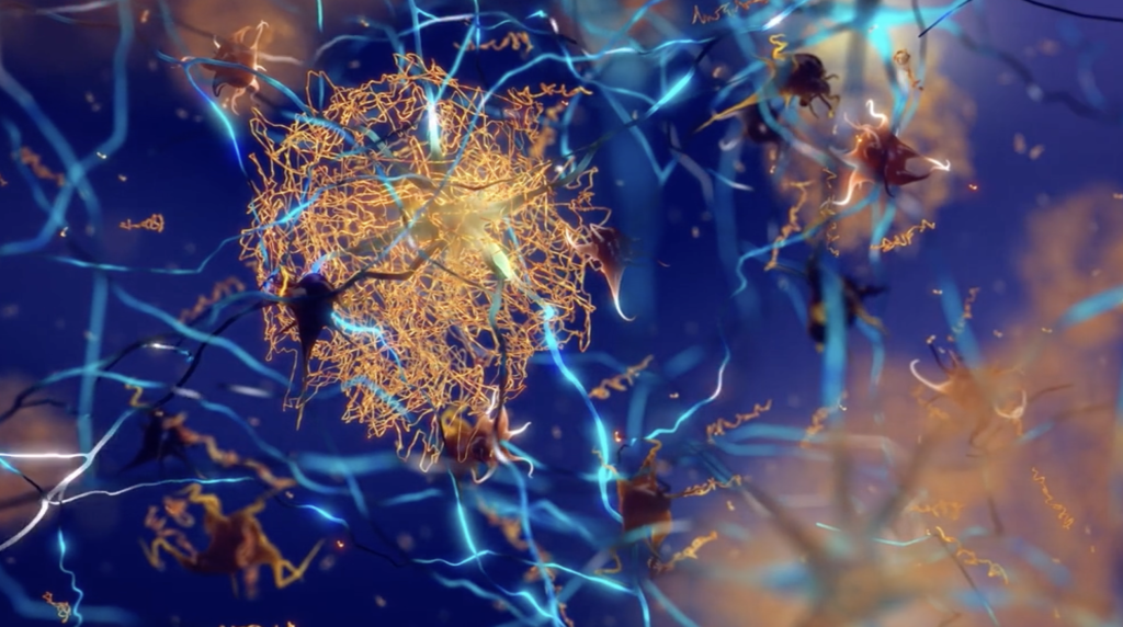 An artist’s interpretation of amyloid fibrils clumping around a nerve cell. Dark blue background with four yellow clusters and light blue fibers coming off of them