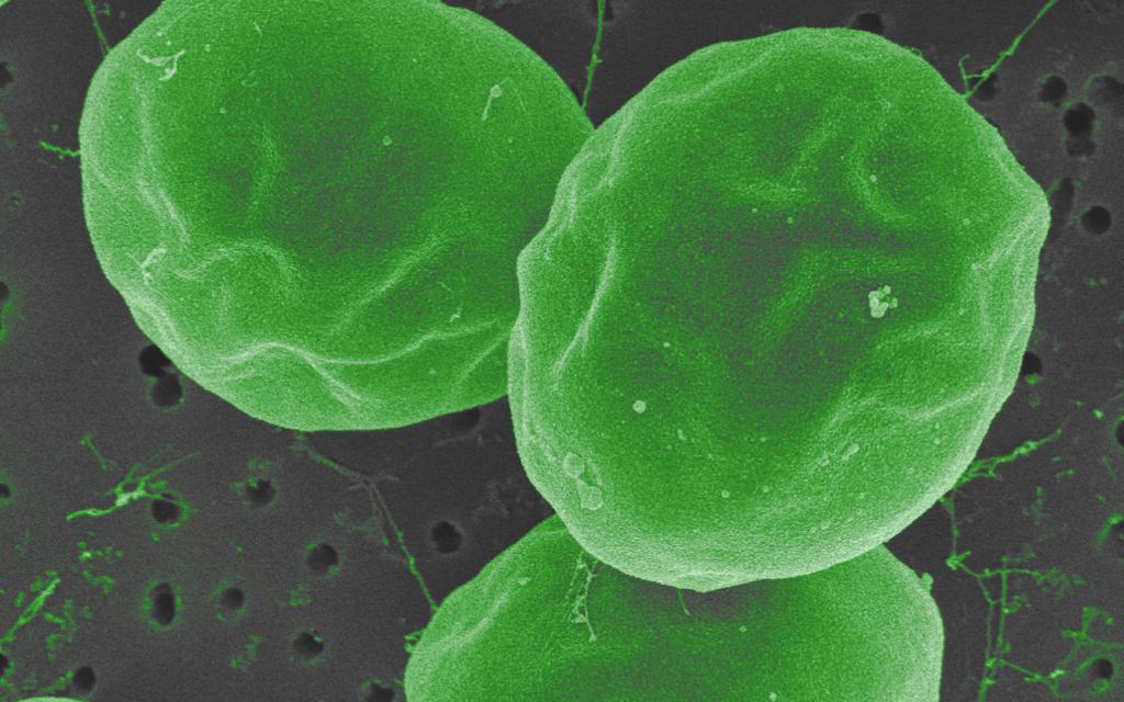 close up shot of freshwater microalgae Chlorella vulgaris