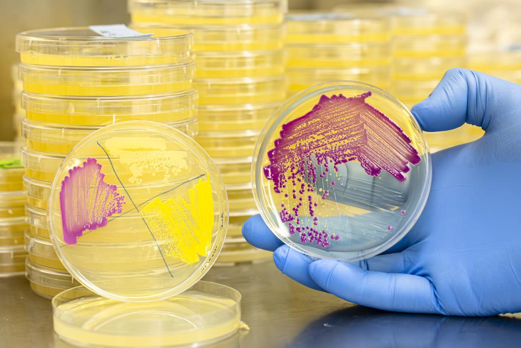 colorful plates with vibrant microbes