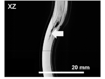 X-Ray CT showing failure inside layered structure of EV battery cell after deformation