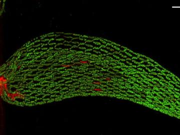 Beneficial microbes, shown in red, aid Sphagnum mosses in using nitrogen from the air to fuel plant growth. ORNL scientists have shown this nitrogen fixing activity declines with warming temperatures. Credit: David Weston/Oak Ridge National Laboratory, U.S. Dept. of Energy