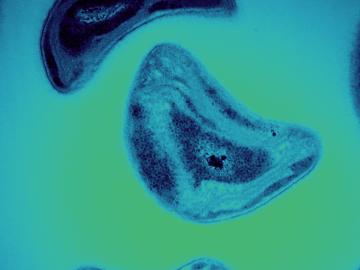 Researchers gained new insights into the mechanisms some methane-feeding bacteria called methanotrophs (pictured) use to break down the toxin methylmercury. Credit: Andy Sproles/ORNL, U.S. Dept. of Energy; Jeremy Semrau/Univ. of Michigan