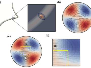 High Performance Adaptive Physics Refinement to Enable Large-Scale Tracking of Cancer Cell Trajectory