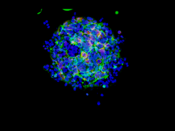 Debjani Pal’s photo “Three-Dimensional Breast Cancer Spheroids” won the Director’s Choice Award in Oak Ridge National Laboratory’s Art of Science photo competition. It will be displayed at the American Museum of Science and Energy in Oak Ridge, Tenn. Credit: Debjani Pal/ORNL, U.S. Dept. of Energy