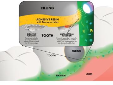 Illustration of a tooth cross-section showing a dental filling adhered with adhesive resin containing nanoparticles. The resin layer is highlighted in yellow, with labels indicating its bioactive function (preventing cracks by forming crystals in micro-gaps) and antibacterial function (killing bacteria on contact, enhanced by visible light). The surrounding gum tissue and biofilm are also depicted, emphasizing the protective properties of the adhesive.