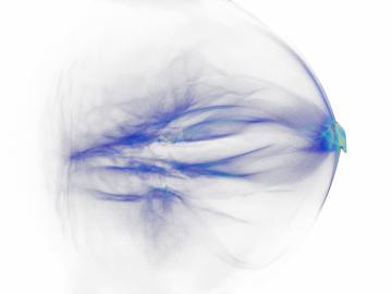 A 3D visualization of the HZDR team’s final simulation of their expanded plastic target. The protons (blue) can be seen traveling along the laser axis from left to right (laser not shown). A particle bunch (red) of high-density protons can be seen at the A 3D visualization of the HZDR team’s final simulation of their expanded plastic target. The protons (blue) can be seen traveling along the laser axis from left to right (laser not shown). A particle bunch (red) of high-density protons can be seen at the