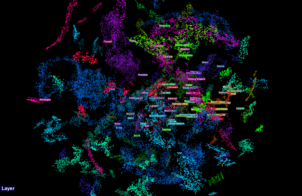 The image visualizes how the team’s multitask convolutional neural network classifies primary cancer sites. Image credit: Hong-Jun Yoon/ORNL