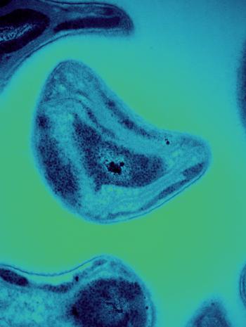 Researchers gained new insights into the mechanisms some methane-feeding bacteria called methanotrophs (pictured) use to break down the toxin methylmercury. Credit: Andy Sproles/ORNL, U.S. Dept. of Energy; Jeremy Semrau/Univ. of Michigan