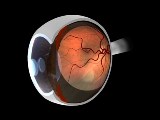 ORNL and UT researchers have created a better, quicker way to screen patients for eye diseases such as diabetic retinopathy and age-related macular degeneration.