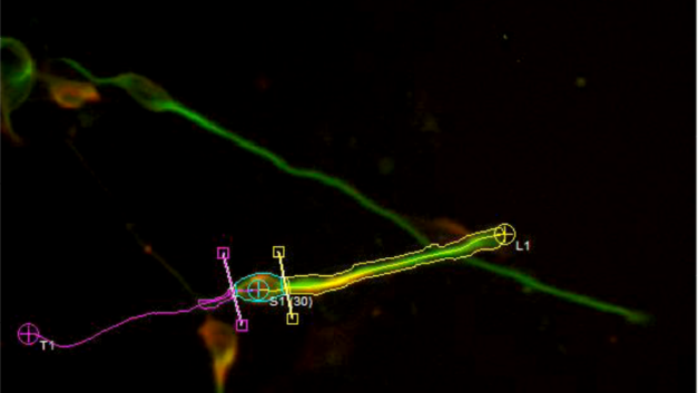 Neuroscience – Faster image processing