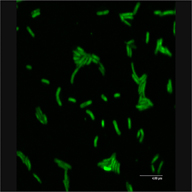 Microorganisms in toxic groundwater fine-tuned to survive